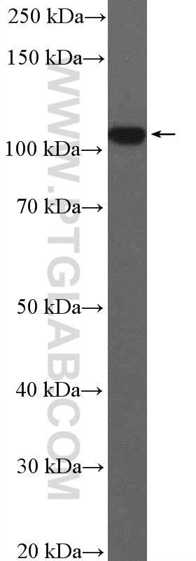 Western Blot (WB) analysis of HeLa cells using SRPK2 Polyclonal antibody (25417-1-AP)