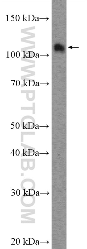 Western Blot (WB) analysis of HeLa cells using SRPK2 Polyclonal antibody (25417-1-AP)