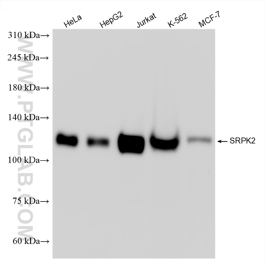 Western Blot (WB) analysis of various lysates using SRPK2 Recombinant antibody (85613-5-RR)