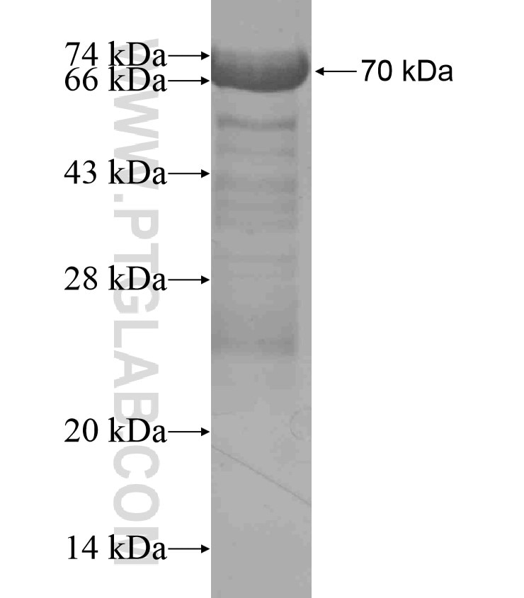 SRPK2 fusion protein Ag17885 SDS-PAGE