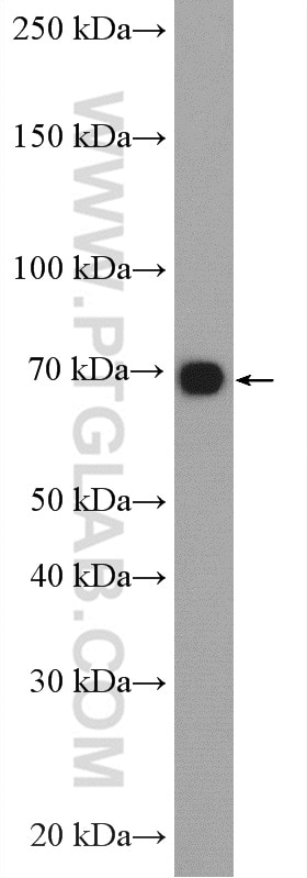 Western Blot (WB) analysis of MCF-7 cells using SRPR Polyclonal antibody (12090-1-AP)