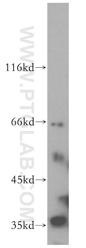 Western Blot (WB) analysis of mouse liver tissue using SRPR Polyclonal antibody (12090-1-AP)