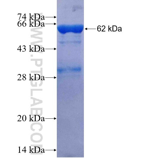 SRPR fusion protein Ag2730 SDS-PAGE