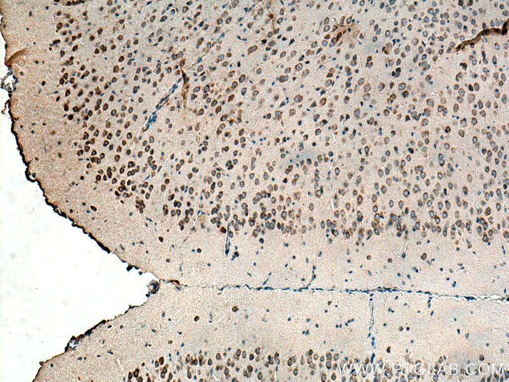 Immunohistochemistry (IHC) staining of mouse brain tissue using SRPRB Polyclonal antibody (14636-1-AP)