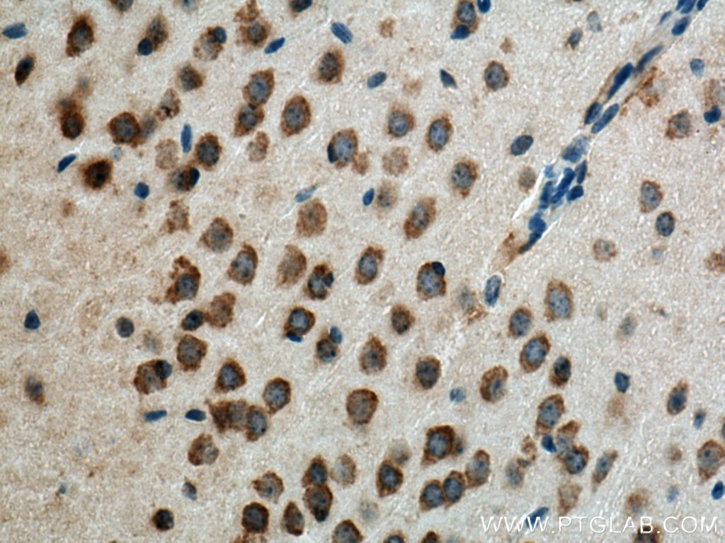 Immunohistochemistry (IHC) staining of mouse brain tissue using SRPRB Polyclonal antibody (14636-1-AP)