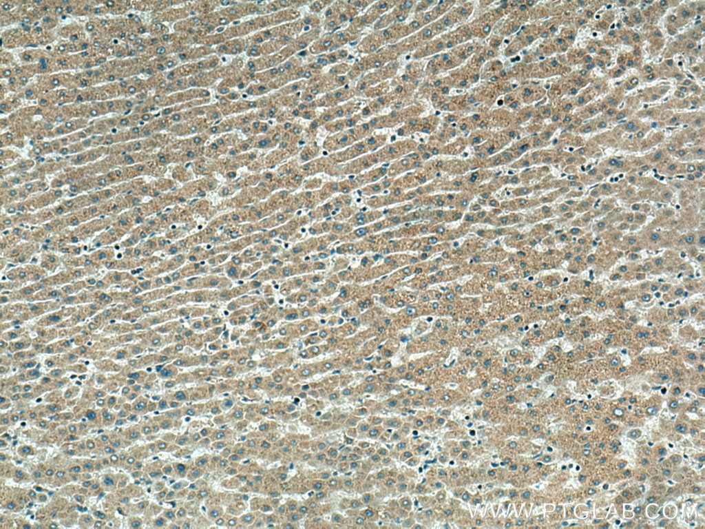 Immunohistochemistry (IHC) staining of human liver tissue using SRPRB Polyclonal antibody (14636-1-AP)