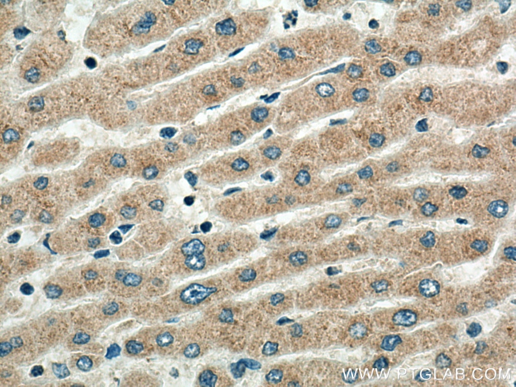 Immunohistochemistry (IHC) staining of human liver tissue using SRPRB Polyclonal antibody (14636-1-AP)