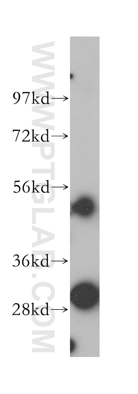 Western Blot (WB) analysis of HepG2 cells using SRPRB Polyclonal antibody (14636-1-AP)