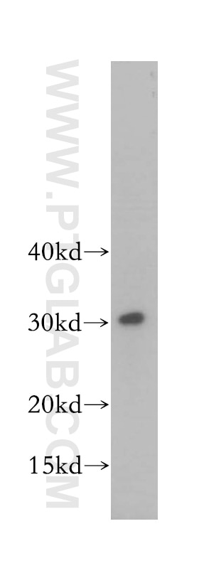 Western Blot (WB) analysis of human liver tissue using SRPRB Polyclonal antibody (14636-1-AP)