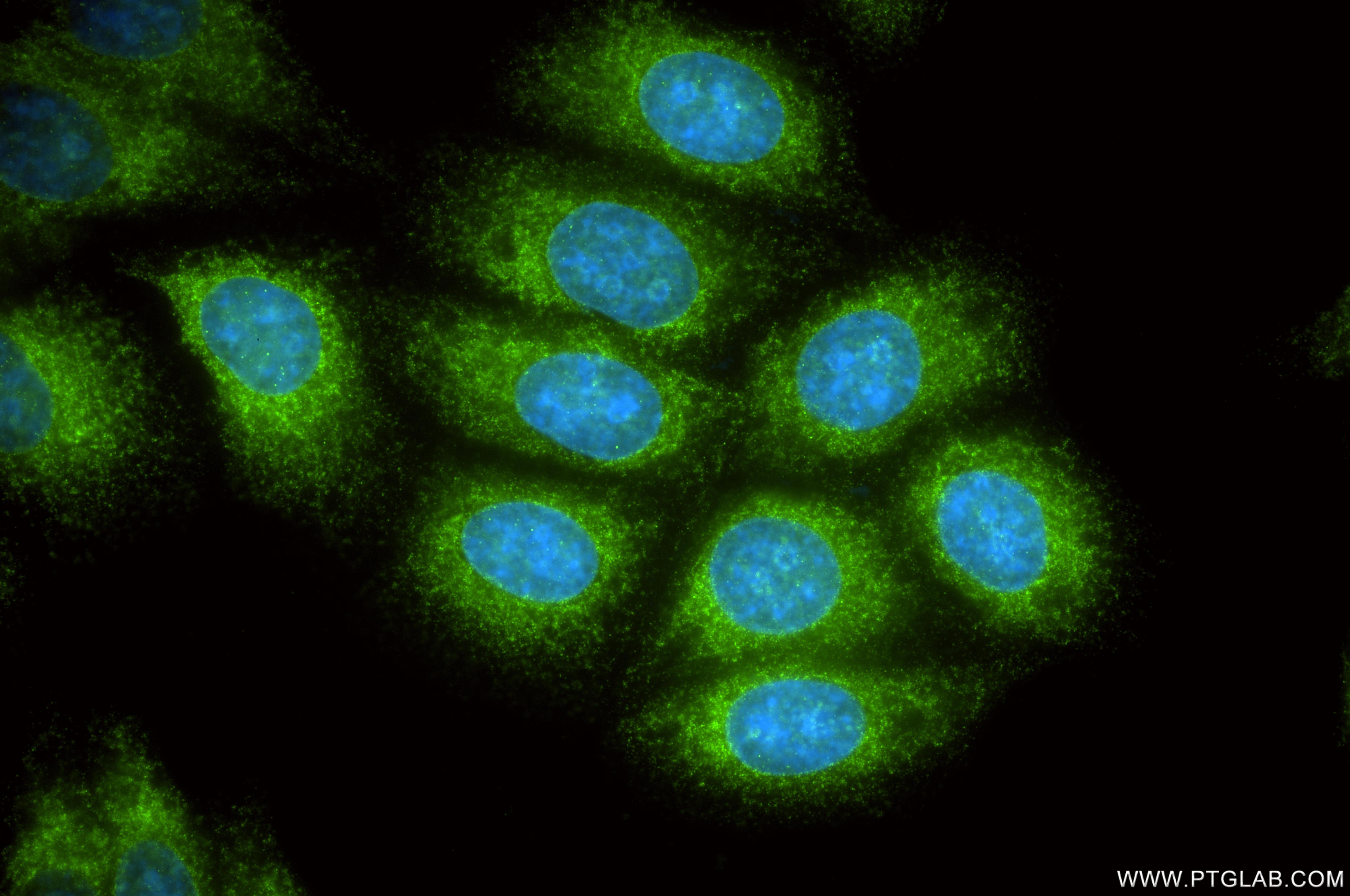 Immunofluorescence (IF) / fluorescent staining of HepG2 cells using SRPRB Recombinant monoclonal antibody (85926-2-RR)