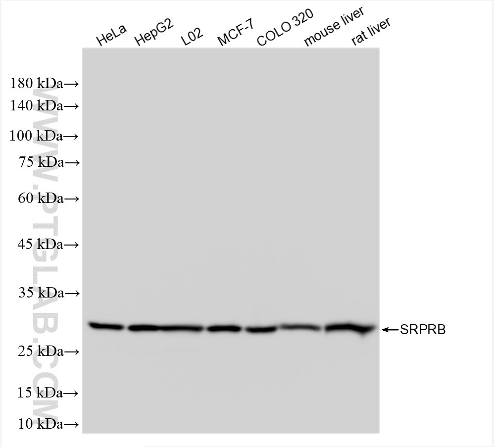 Western Blot (WB) analysis of various lysates using SRPRB Recombinant antibody (85926-2-RR)