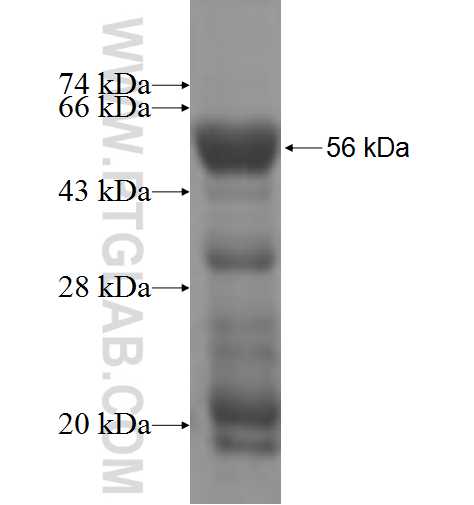 SRPRB fusion protein Ag6215 SDS-PAGE
