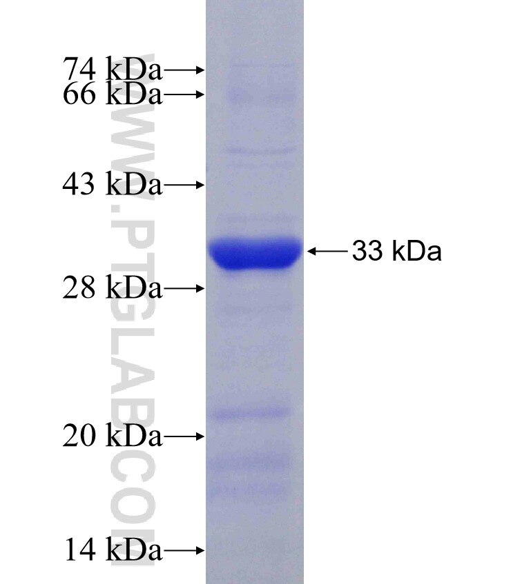 SRPRB fusion protein Ag6350 SDS-PAGE