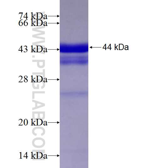 SRPX fusion protein Ag9876 SDS-PAGE