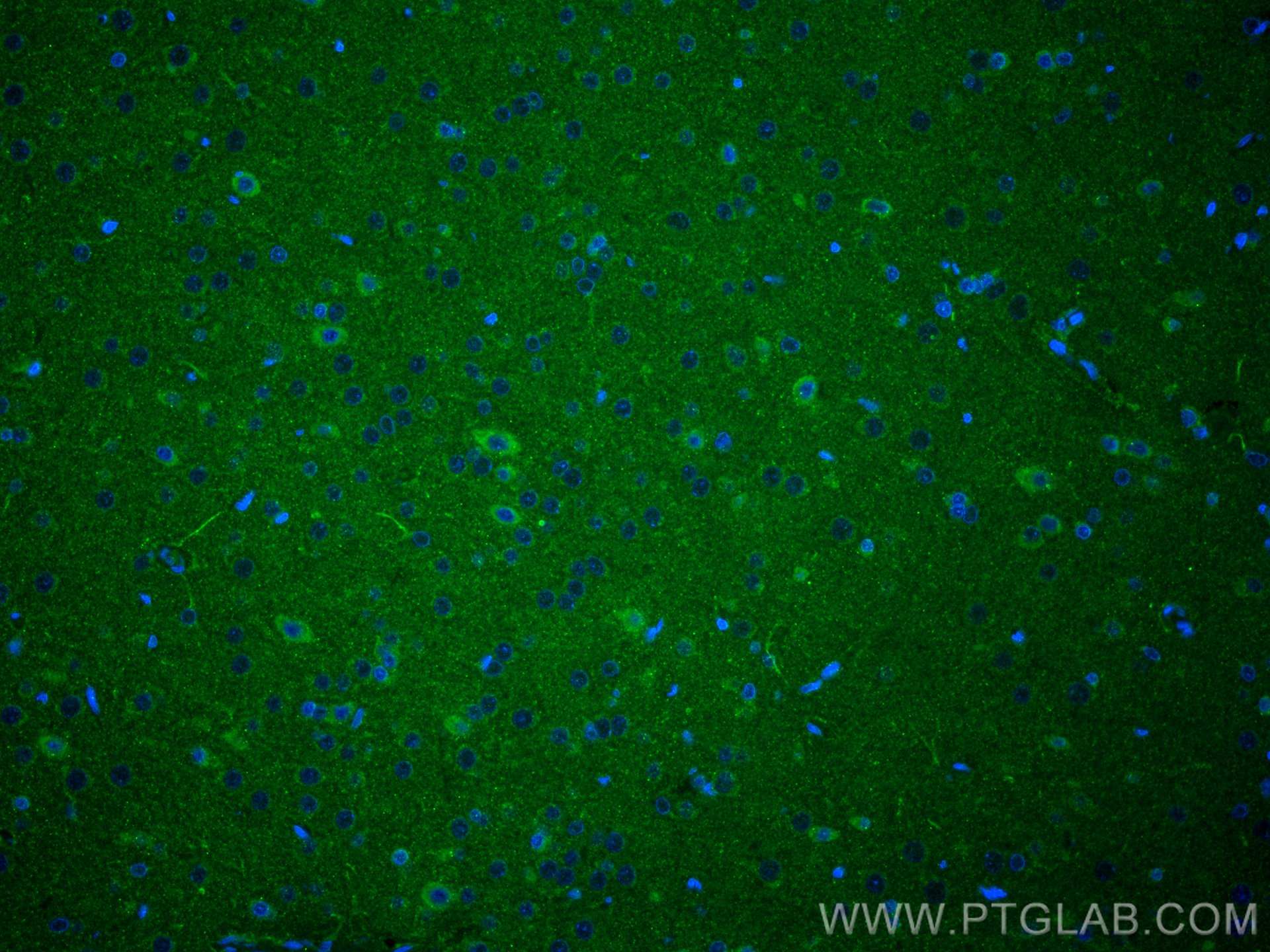 Immunofluorescence (IF) / fluorescent staining of rat brain tissue using SRPX2 Polyclonal antibody (11845-1-AP)