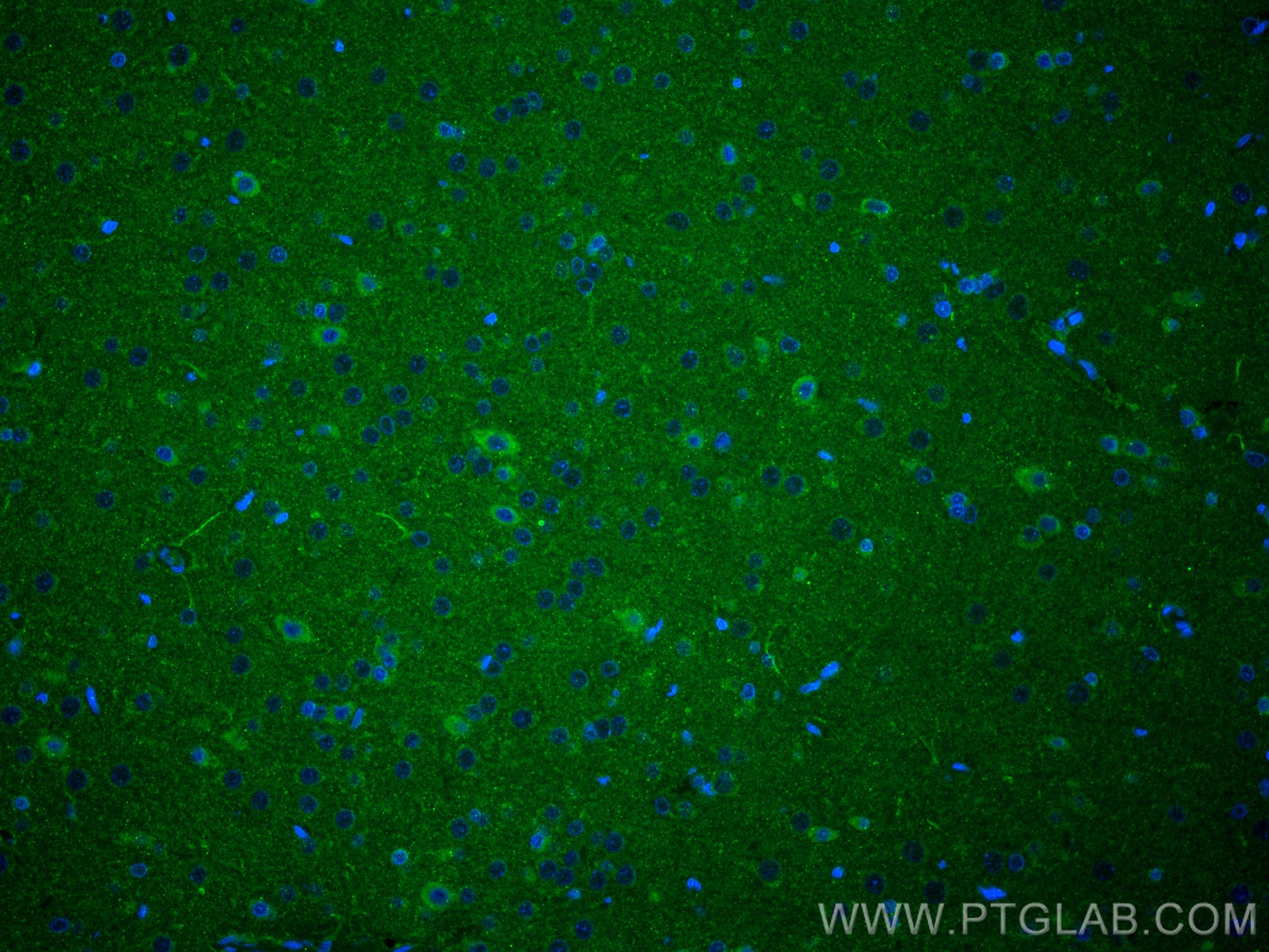 IF Staining of rat brain using 11845-1-AP