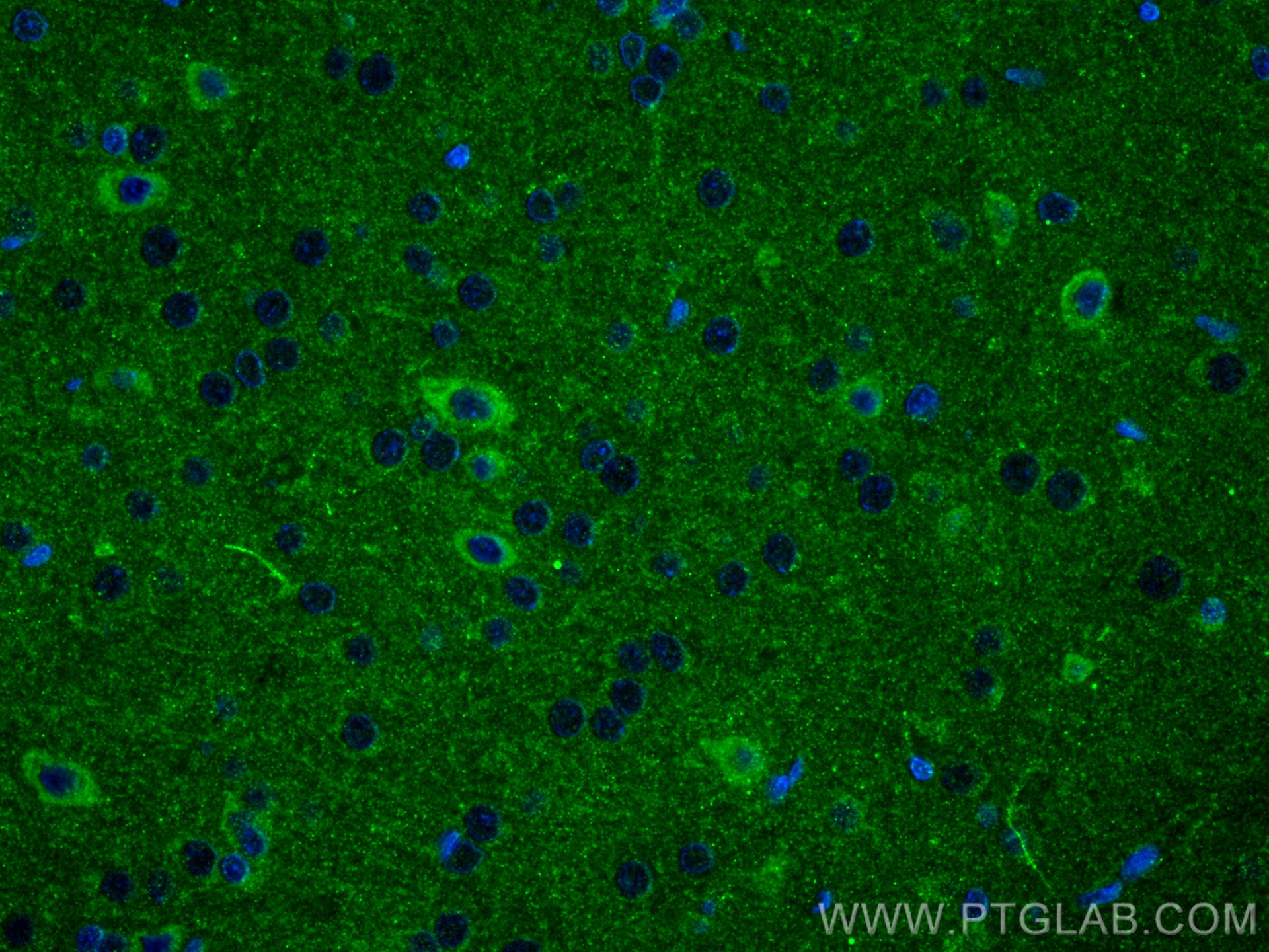 Immunofluorescence (IF) / fluorescent staining of rat brain tissue using SRPX2 Polyclonal antibody (11845-1-AP)