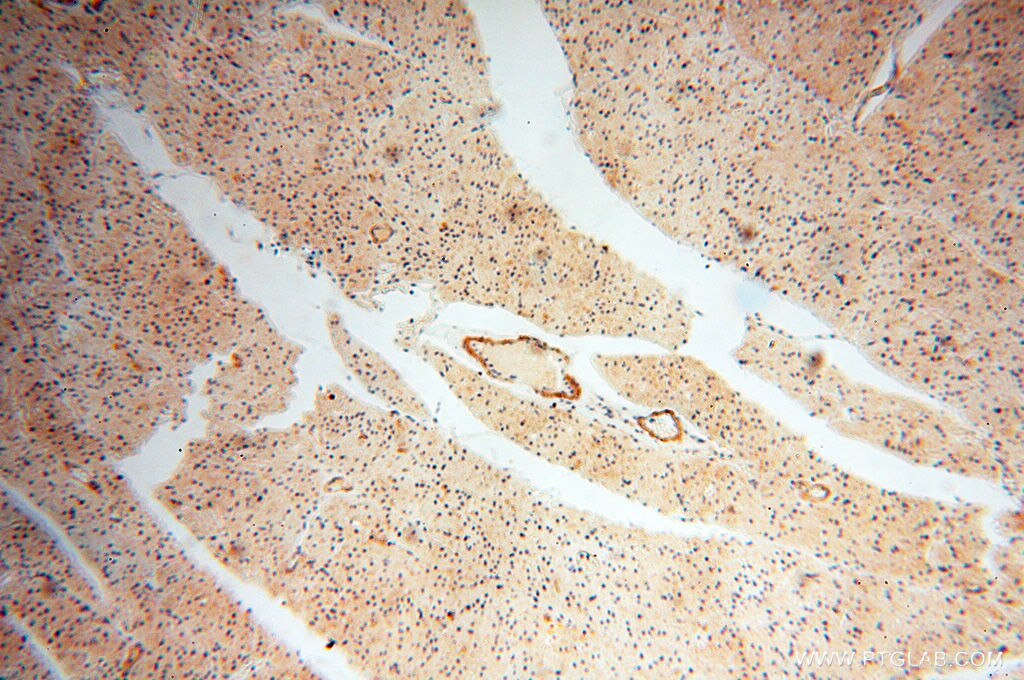 Immunohistochemistry (IHC) staining of human heart tissue using SRPX2 Polyclonal antibody (11845-1-AP)