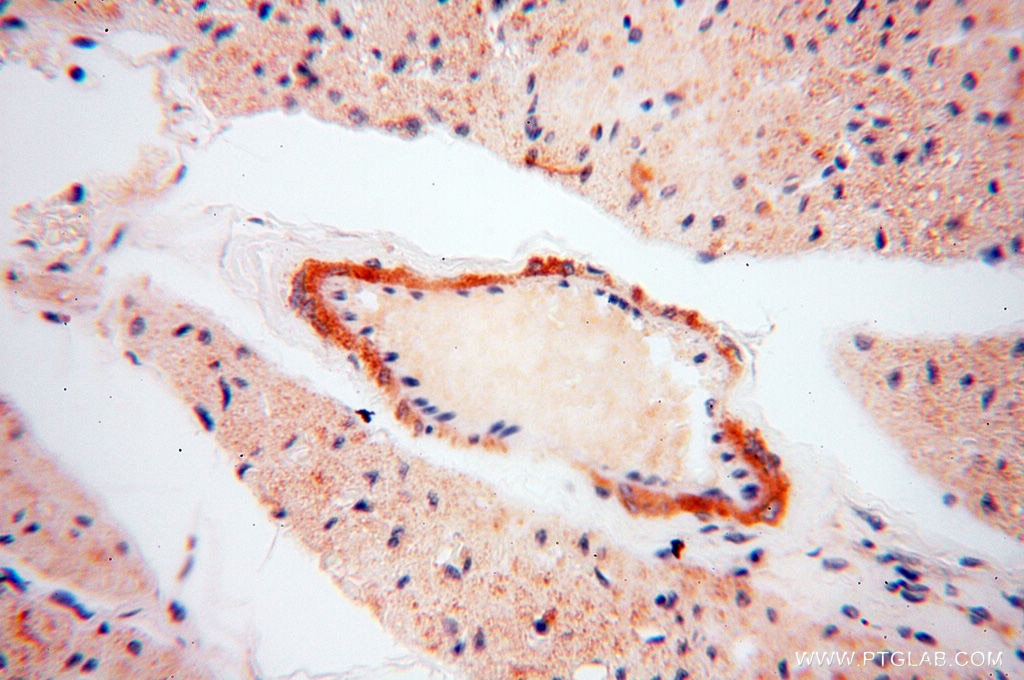 Immunohistochemistry (IHC) staining of human heart tissue using SRPX2 Polyclonal antibody (11845-1-AP)