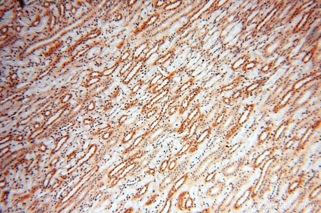 Immunohistochemistry (IHC) staining of human kidney tissue using SRPX2 Polyclonal antibody (11845-1-AP)
