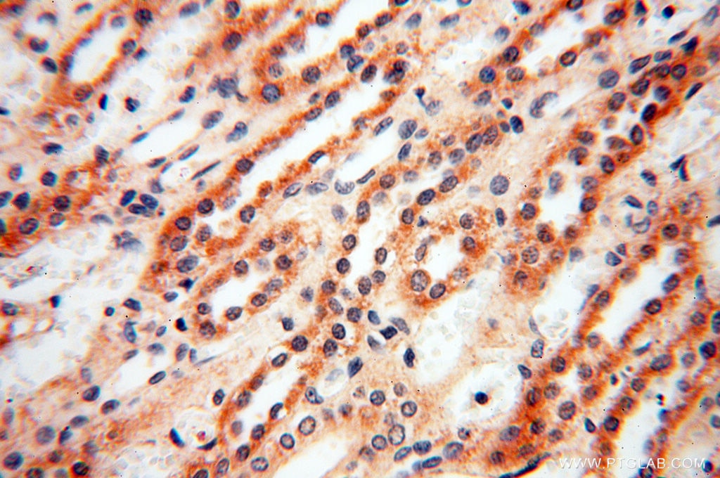 Immunohistochemistry (IHC) staining of human kidney tissue using SRPX2 Polyclonal antibody (11845-1-AP)