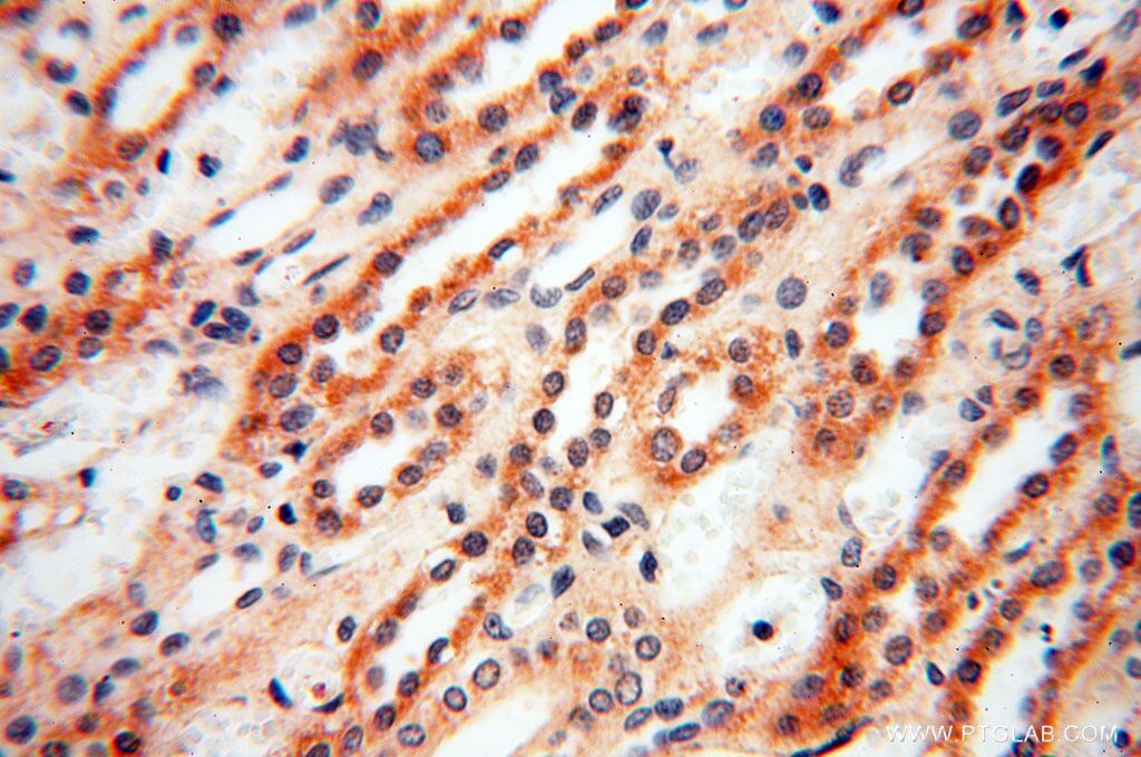 IHC staining of human kidney using 11845-1-AP