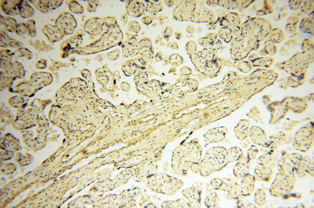 Immunohistochemistry (IHC) staining of human placenta tissue using SRPX2 Polyclonal antibody (11845-1-AP)