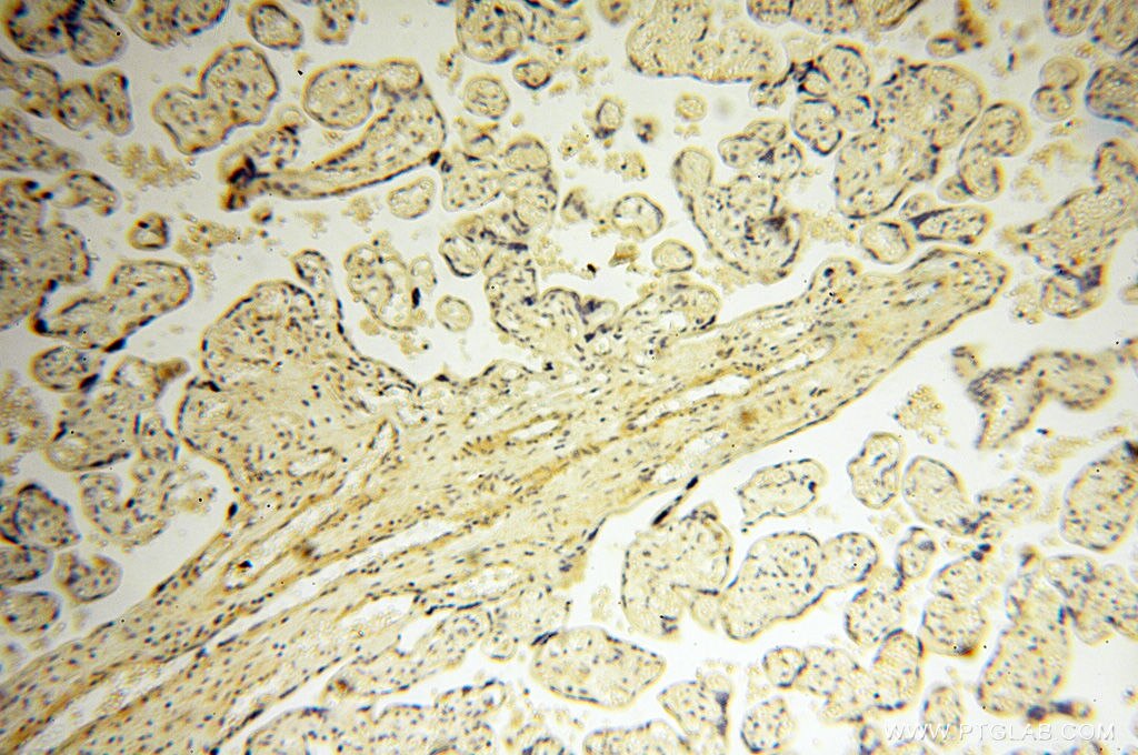 Immunohistochemistry (IHC) staining of human placenta tissue using SRPX2 Polyclonal antibody (11845-1-AP)