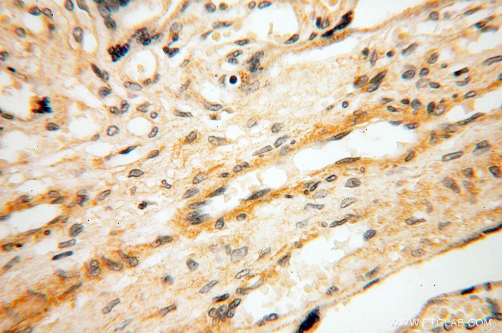 Immunohistochemistry (IHC) staining of human placenta tissue using SRPX2 Polyclonal antibody (11845-1-AP)