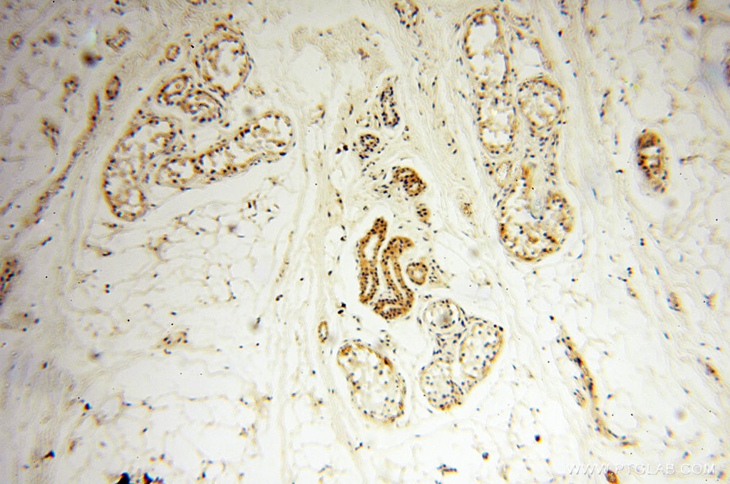 Immunohistochemistry (IHC) staining of human skin tissue using SRPX2 Polyclonal antibody (11845-1-AP)