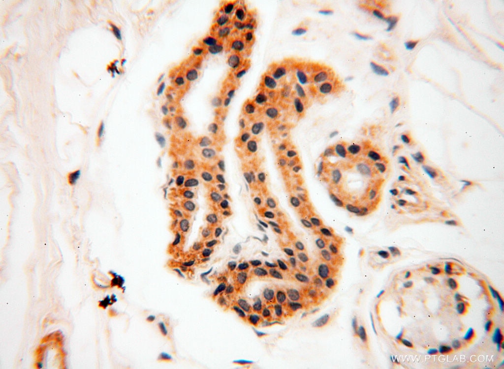 Immunohistochemistry (IHC) staining of human skin tissue using SRPX2 Polyclonal antibody (11845-1-AP)