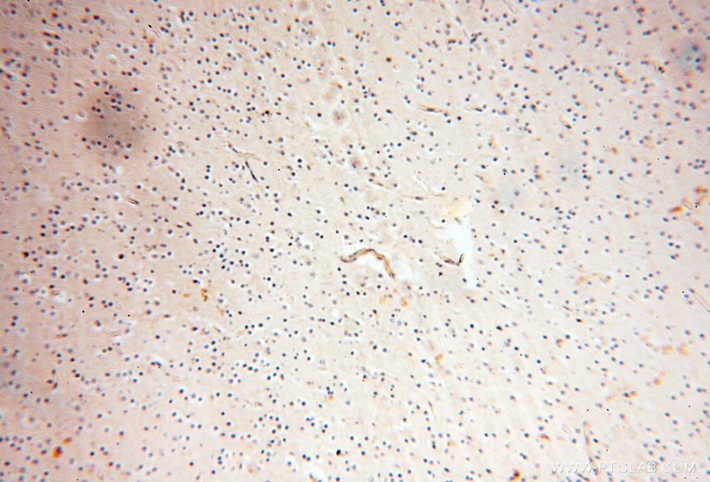 Immunohistochemistry (IHC) staining of human brain tissue using SRPX2 Polyclonal antibody (11845-1-AP)