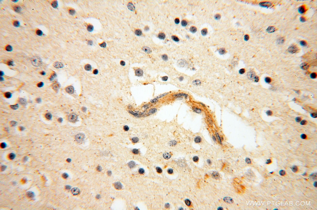 IHC staining of human brain using 11845-1-AP