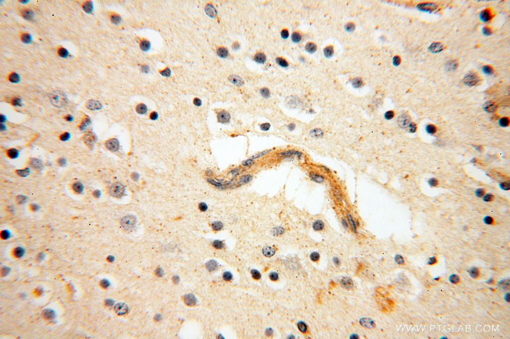 Immunohistochemistry (IHC) staining of human brain tissue using SRPX2 Polyclonal antibody (11845-1-AP)