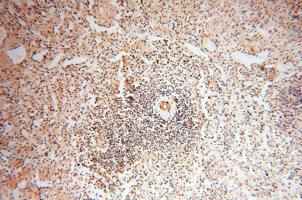 Immunohistochemistry (IHC) staining of human spleen tissue using SRPX2 Polyclonal antibody (11845-1-AP)