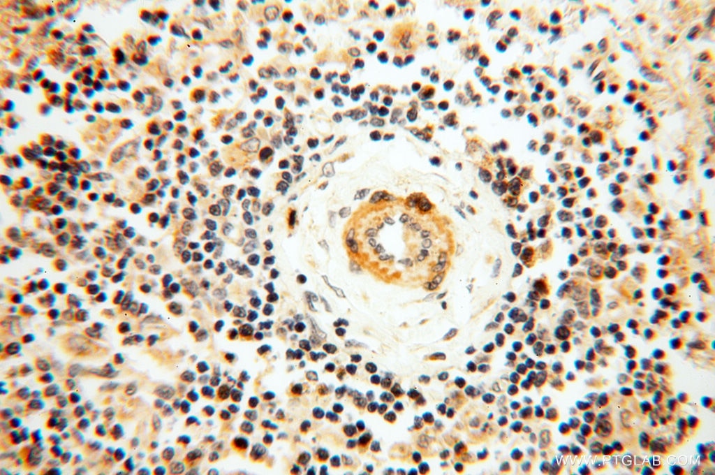 Immunohistochemistry (IHC) staining of human spleen tissue using SRPX2 Polyclonal antibody (11845-1-AP)