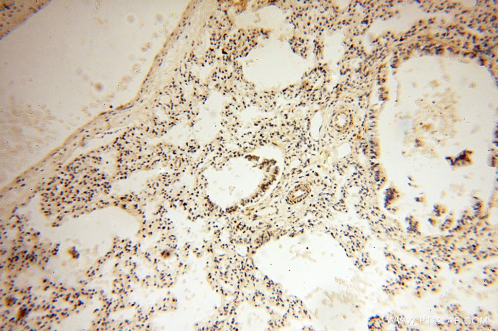 Immunohistochemistry (IHC) staining of human lung tissue using SRPX2 Polyclonal antibody (11845-1-AP)