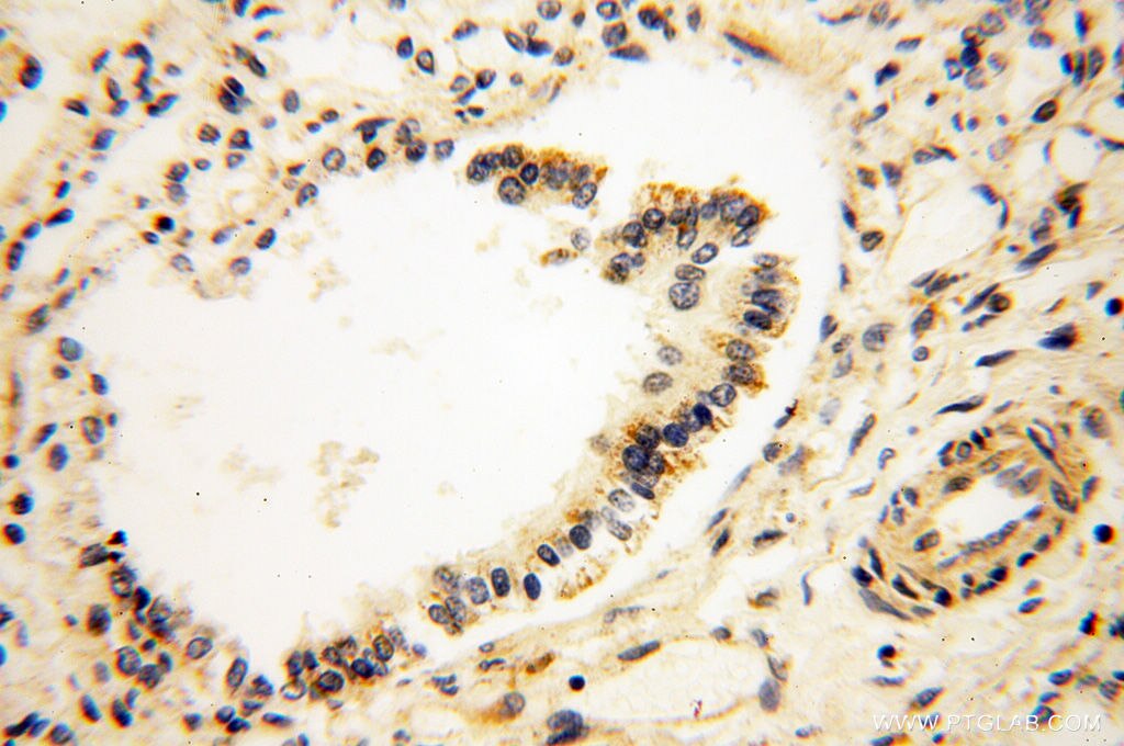 Immunohistochemistry (IHC) staining of human lung tissue using SRPX2 Polyclonal antibody (11845-1-AP)