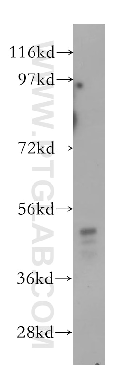 Western Blot (WB) analysis of human brain tissue using SRPX2 Polyclonal antibody (11845-1-AP)