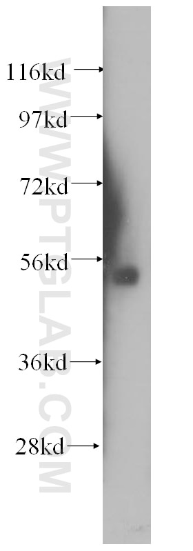 Western Blot (WB) analysis of human placenta tissue using SRPX2 Polyclonal antibody (11845-1-AP)