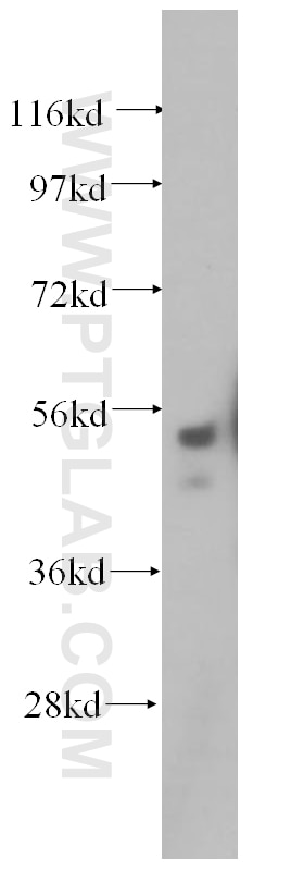 Western Blot (WB) analysis of HepG2 cells using SRPX2 Polyclonal antibody (11845-1-AP)