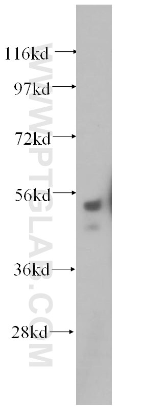 Western Blot (WB) analysis of HepG2 cells using SRPX2 Polyclonal antibody (11845-1-AP)