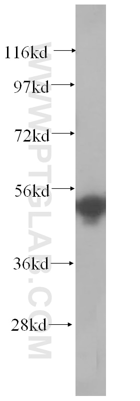 Western Blot (WB) analysis of human kidney tissue using SRPX2 Polyclonal antibody (11845-1-AP)
