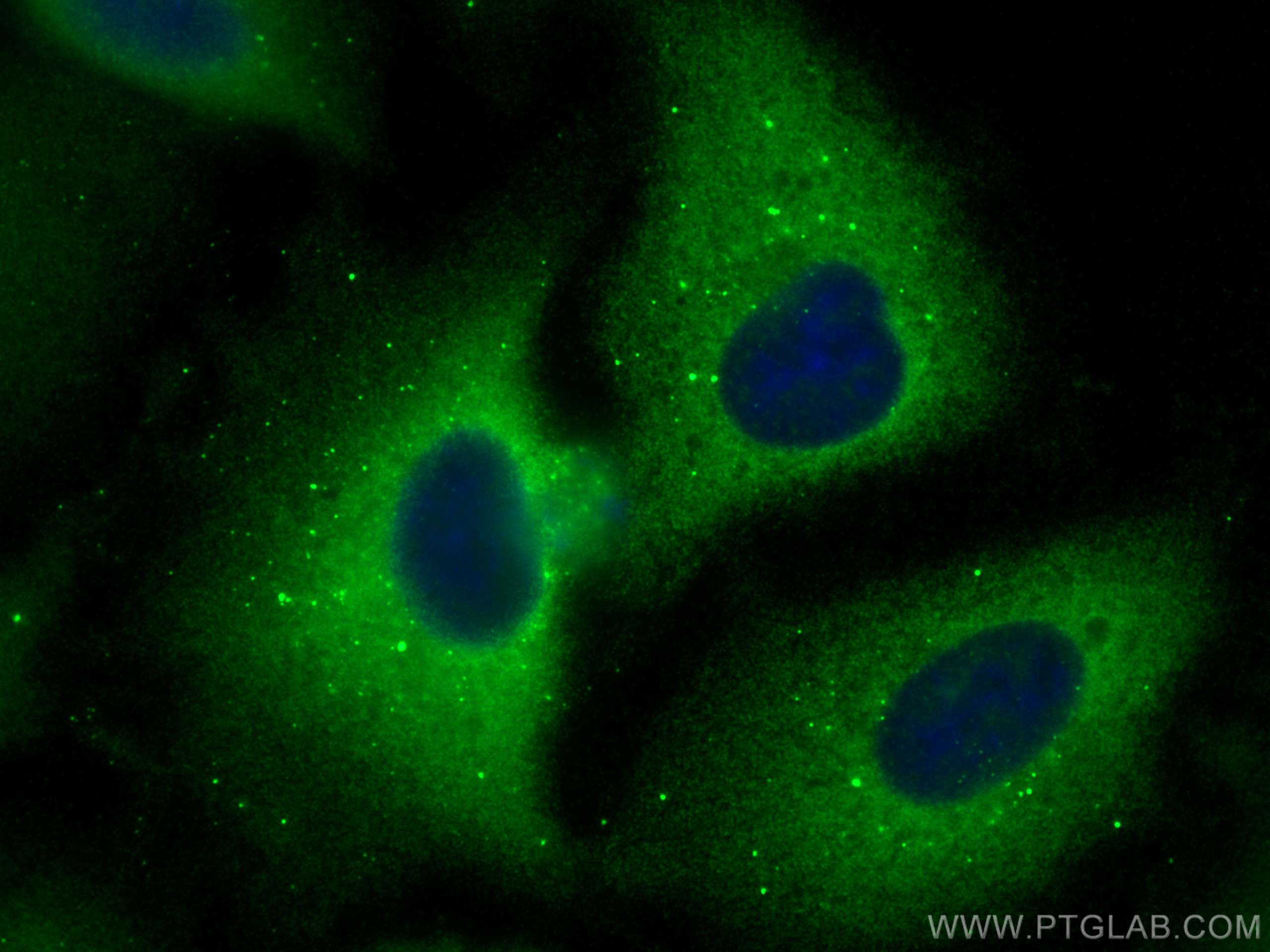 Immunofluorescence (IF) / fluorescent staining of A549 cells using SRPX2 Monoclonal antibody (66266-1-Ig)