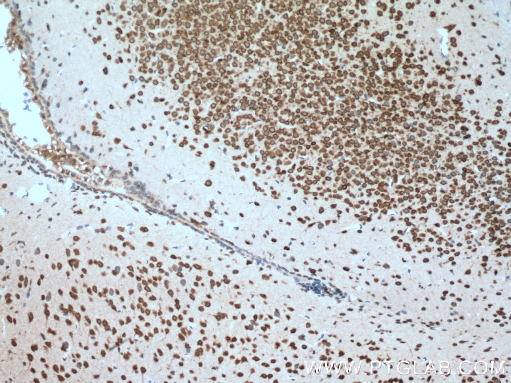 Immunohistochemistry (IHC) staining of mouse brain tissue using SRPX2 Monoclonal antibody (66266-1-Ig)