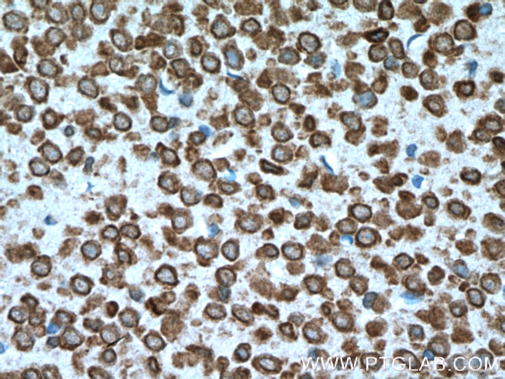 Immunohistochemistry (IHC) staining of mouse brain tissue using SRPX2 Monoclonal antibody (66266-1-Ig)