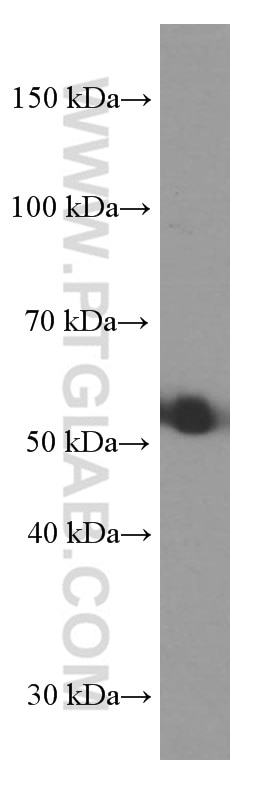 Western Blot (WB) analysis of pig lung tissue using SRPX2 Monoclonal antibody (66266-1-Ig)