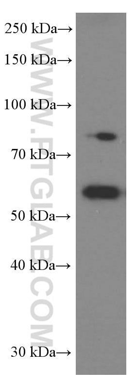 Western Blot (WB) analysis of A549 cells using SRPX2 Monoclonal antibody (66266-1-Ig)