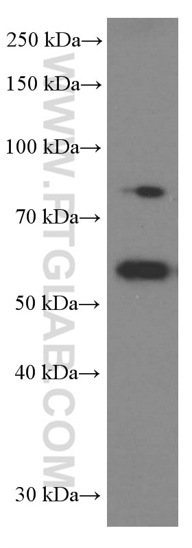 WB analysis of A549 using 66266-1-Ig