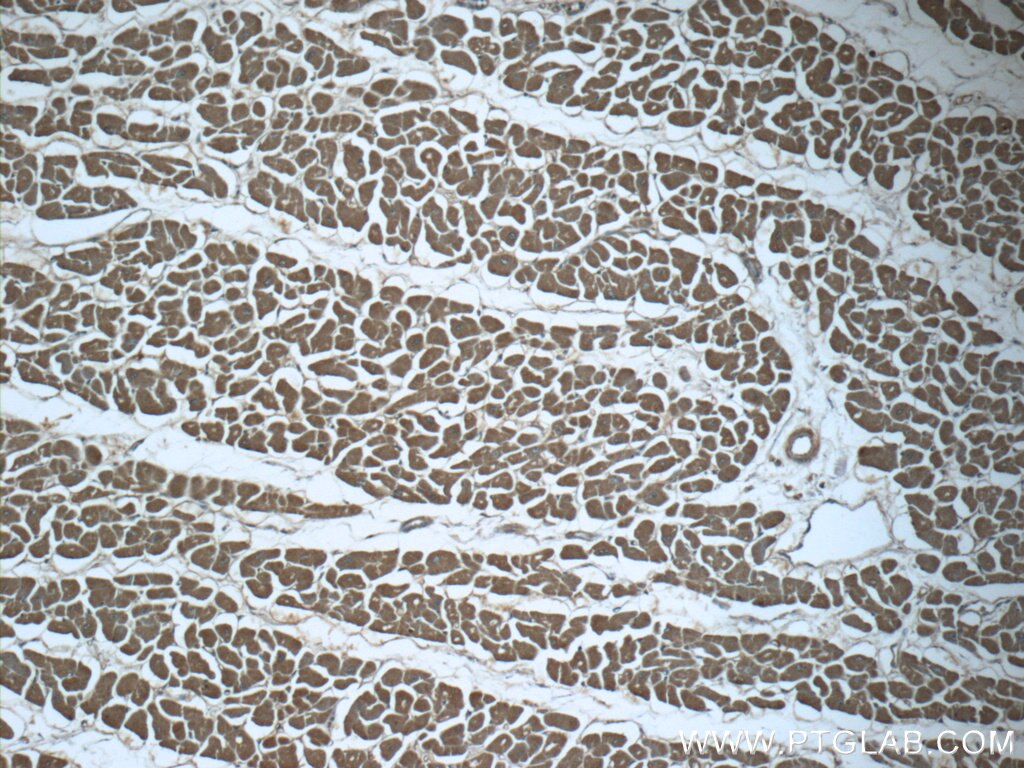 Immunohistochemistry (IHC) staining of human heart tissue using SRR Polyclonal antibody (17955-1-AP)